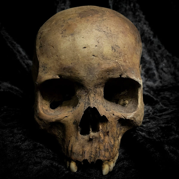 Human skull