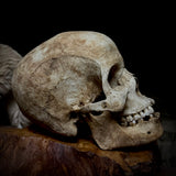 Human skull with mandible