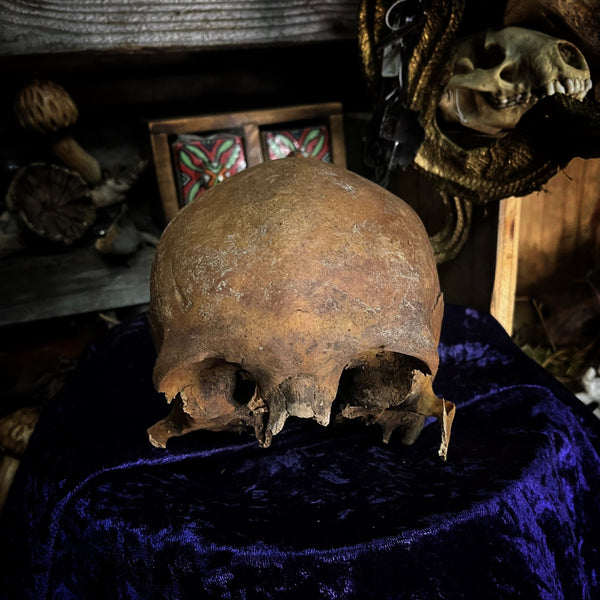 Partial Human skull