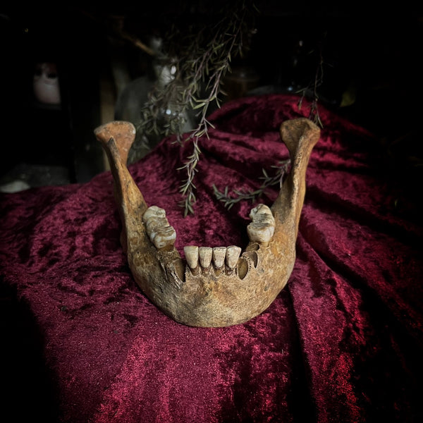 A mandible