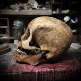 Human skull with mandible