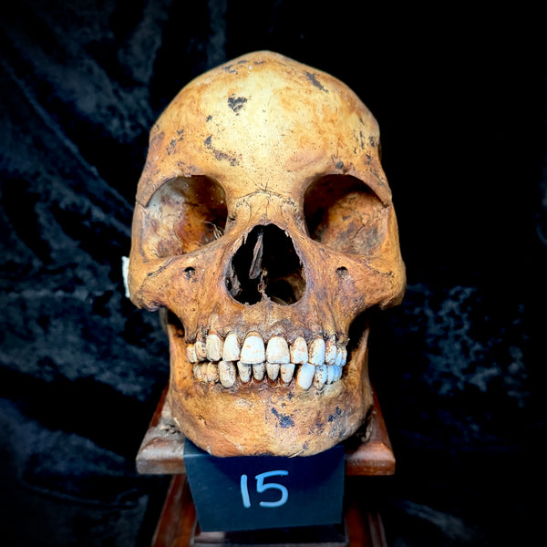 Item 15. Human skull with mandible