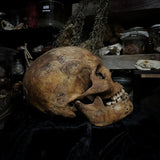 Human skull