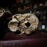Human skull