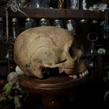 Human skull