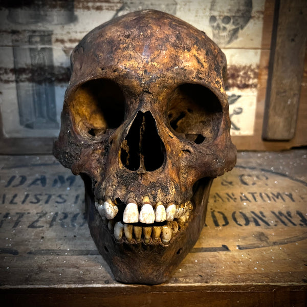 Human skull with mandible