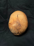 Item 15. Human skull with mandible