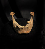 A mandible