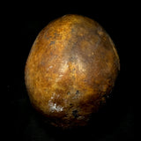 Item 23. Bone cancer skull