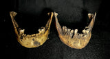 Item 9. Two human mandibles