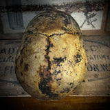 Human skull with mandible
