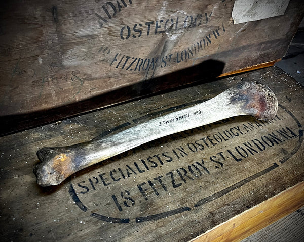 Human tibia (shinbone)