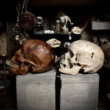 Human skull OR Mystery box