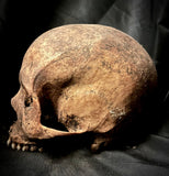 A human skull