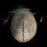Human skull