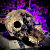 Human skull