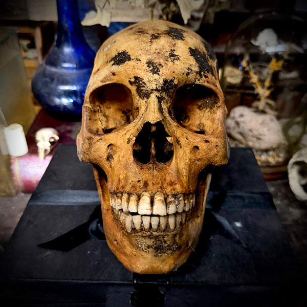 Human skull with mandible