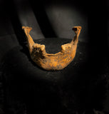 A mandible