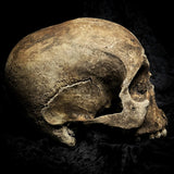 Human skull