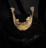 A mandible