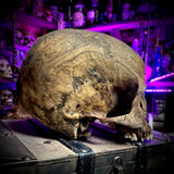 Human skull