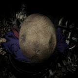 Human skull