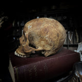 Human skull