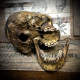 Human skull with mandible