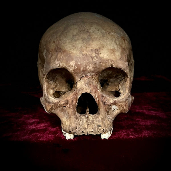 Human Skull