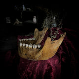 A mandible