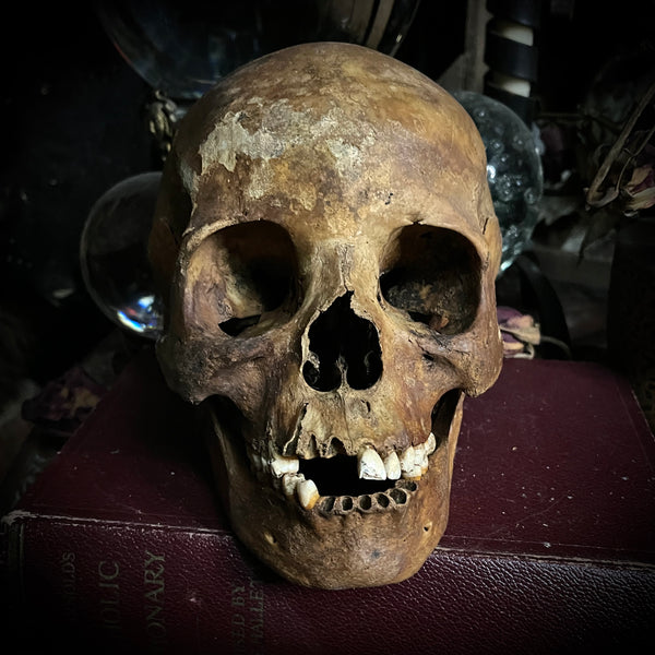 Human skull with mandible
