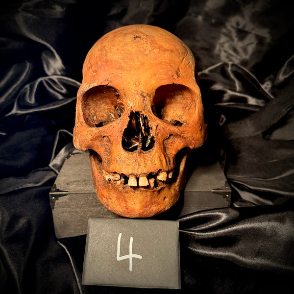 Item 4. Human skull with mandible