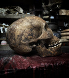 Human skull with mandible