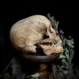 A human skull with mandible