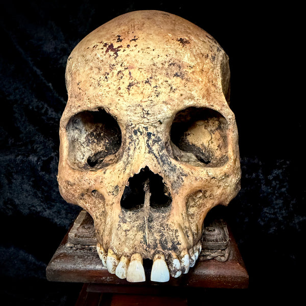 Item 14. Human skull