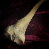 Adam Rouilly Human tibia (shinbone)