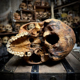 Human skull