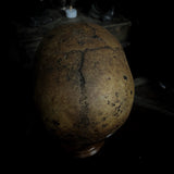 Human skull