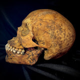 Item 9. Human skull with mandible