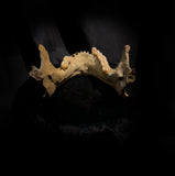 A mandible