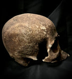 A human skull