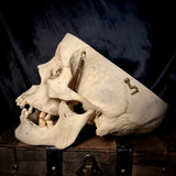 Item 5. Human medical skull