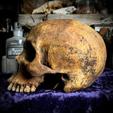 Human skull
