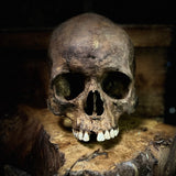 Human skull
