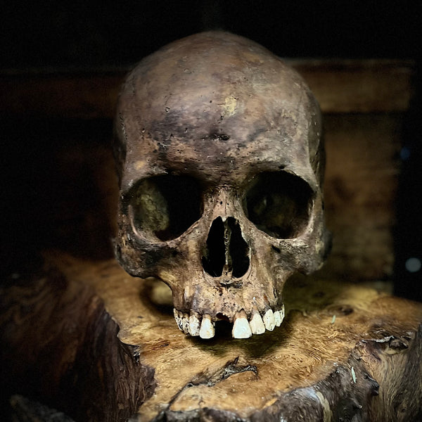 Human skull