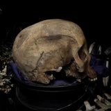 Human skull