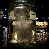 Fetal specimen