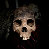 A human skull