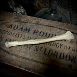 Human radius bone