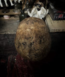 Human skull with mandible